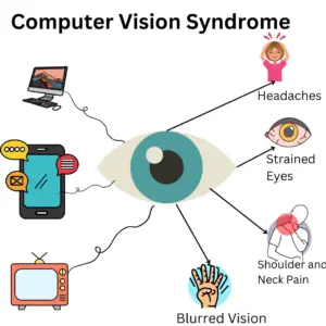 computer vision syndrome bedfordview